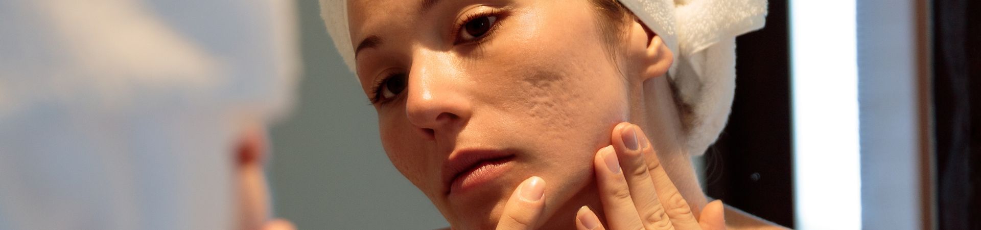 Novità nel trattamento delle cicatrici da acne