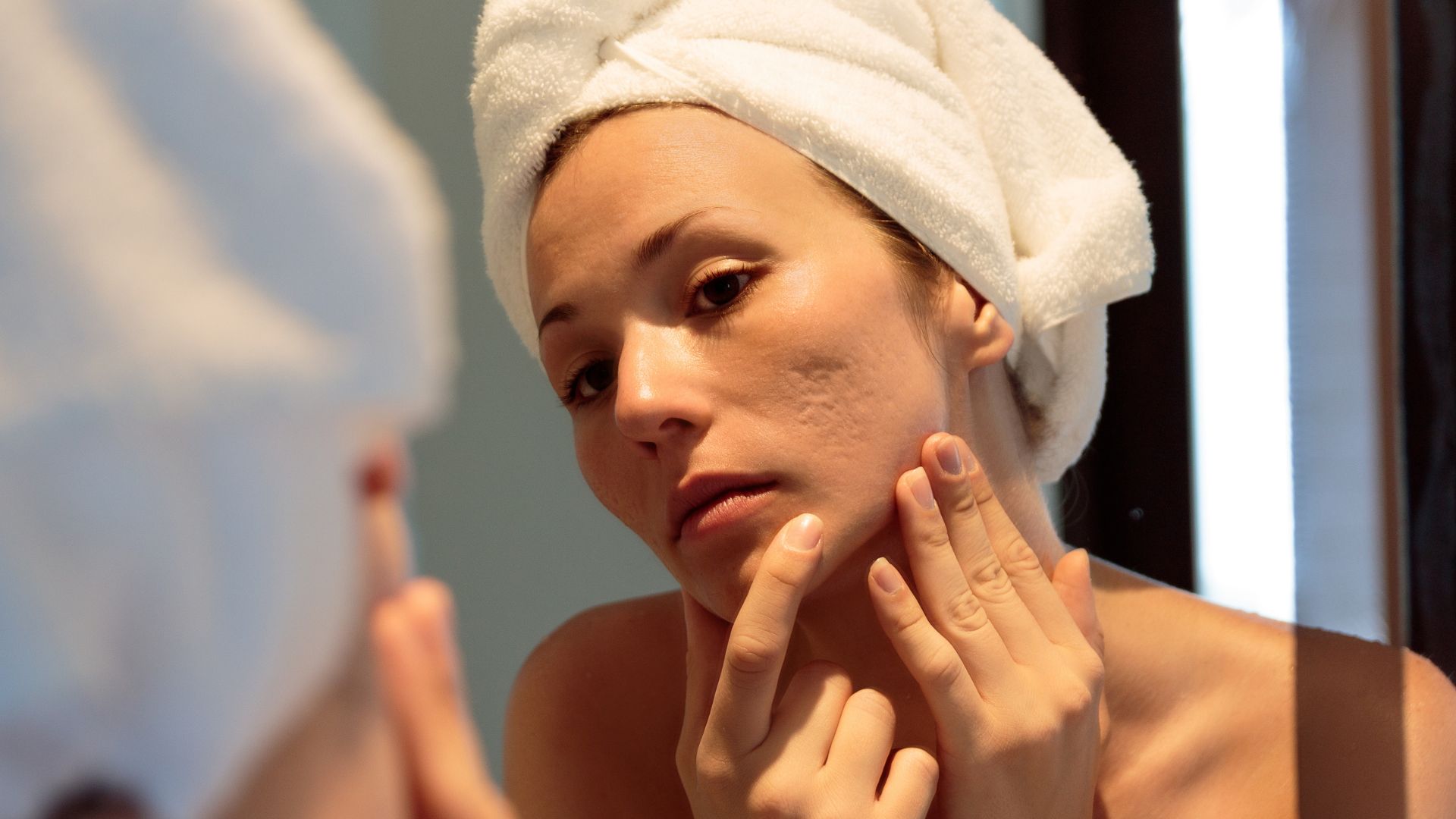 Novità nel trattamento delle cicatrici da acne