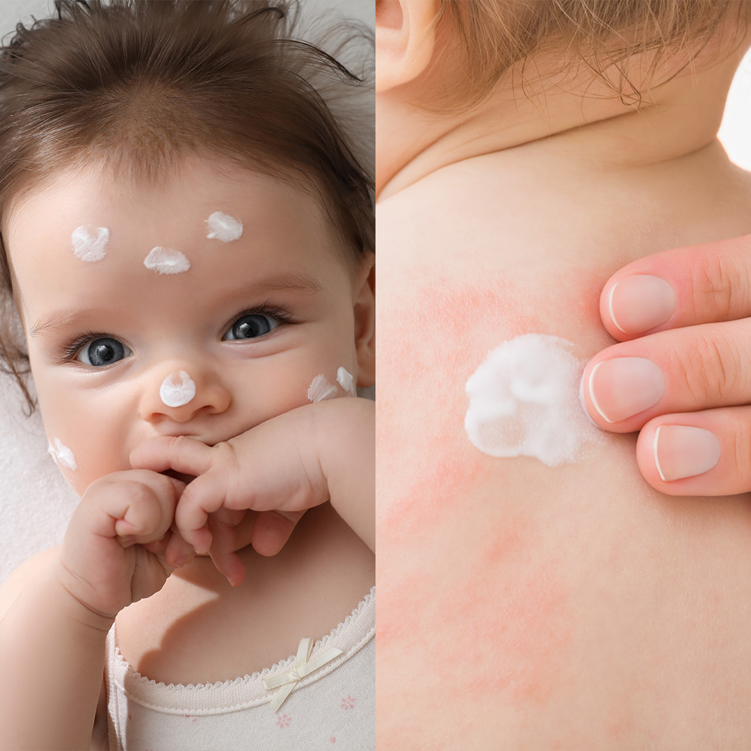 Immagine che raffigura il viso e il corpo di un bambino