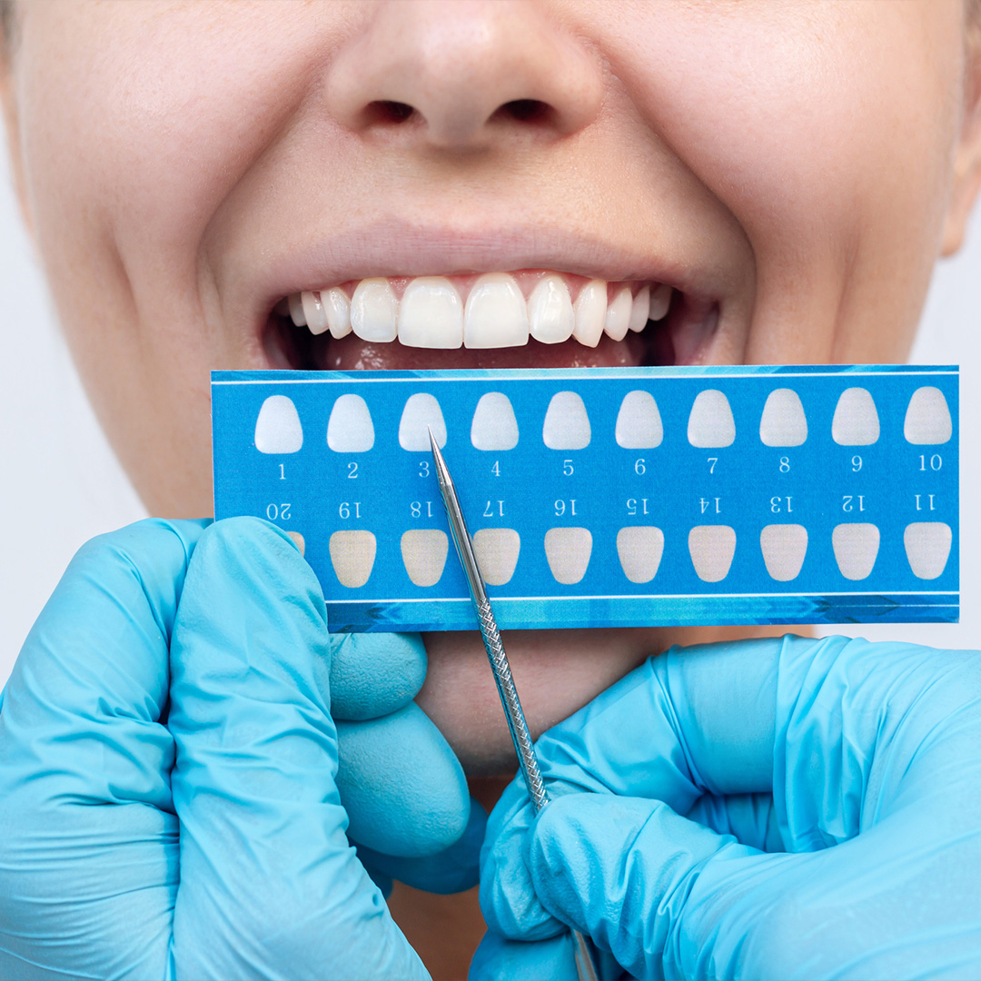 Non altera la colorazione dei denti