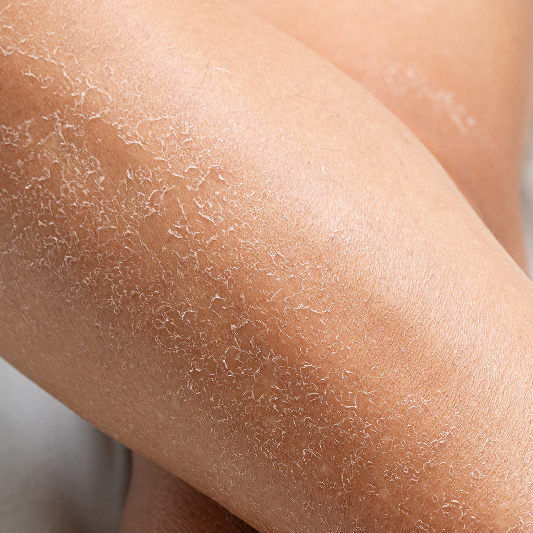 Riequilibra e idrata l'epidermide, con azione emolliente 